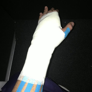Casillas publicó una fotografía sobre su maltrecha mano izquierda